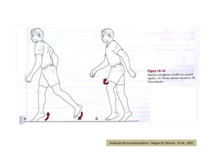 Avaliação Musculoesquelética – Magee,DJ; Manole , 4ª ed., 2005
 