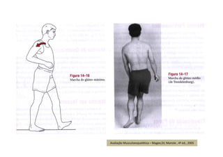 Avaliação Musculoesquelética – Magee,DJ; Manole , 4ª ed., 2005
 