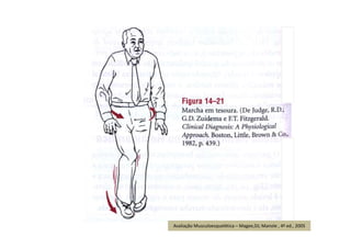 Avaliação Musculoesquelética – Magee,DJ; Manole , 4ª ed., 2005
 