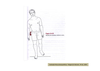 Avaliação Musculoesquelética – Magee,DJ; Manole , 4ª ed., 2005
 