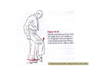 Avaliação Musculoesquelética – Magee,DJ; Manole , 4ª ed., 2005
 