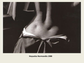 Hoyuelos Normandía 1988
 