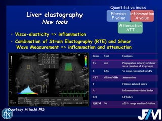 Jean Michel Correas, place and role of shear wave elastography for ...