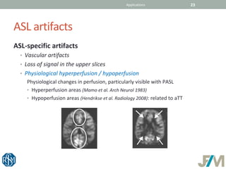 Jean Yves Gauvrit, ASL - Arterial Spin Labeling, jfim ifupi milan 2018 ...
