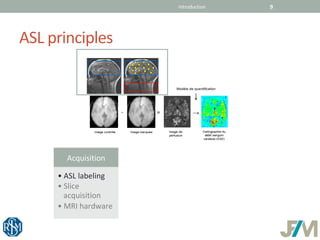 Jean Yves Gauvrit, ASL - Arterial Spin Labeling, jfim ifupi milan 2018 ...