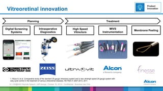 12 | OIS@AAO Keynote Speech | Jeff George | October 16, 2014 | Confidential - Business Use Only
Vitreoretinal innovation
High Speed
Vitrectors
MIVS
Instrumentation
Digital Screening
Systems
Intraoperative
Diagnostics
1. Rizzo S, et al. Comparative study of the standard 25-gauge vitrectomy system and a new ultrahigh-speed 25-gauge system with
duty cycle control in the treatment of various vitreoretinal diseases. RETINA 31:2007-2013, 2011.
Membrane Peeling
Planning Treatment
Product
Innovation
 