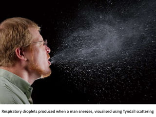 Respiratory droplets produced when a man sneezes, visualised using Tyndall scattering
7
 