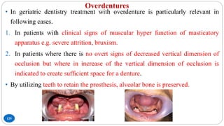 Overdentures
129
• In geriatric dentistry treatment with overdenture is particularly relevant in
following cases.
1. In patients with clinical signs of muscular hyper function of masticatory
apparatus e.g. severe attrition, bruxism.
2. In patients where there is no overt signs of decreased vertical dimension of
occlusion but where in increase of the vertical dimension of occlusion is
indicated to create sufficient space for a denture.
• By utilizing teeth to retain the prosthesis, alveolar bone is preserved.
 