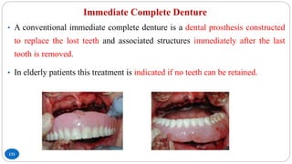 Immediate Complete Denture
131
• A conventional immediate complete denture is a dental prosthesis constructed
to replace the lost teeth and associated structures immediately after the last
tooth is removed.
• In elderly patients this treatment is indicated if no teeth can be retained.
 