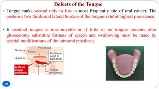 Defects of the Tongue
158
• Tongue ranks second only to lips as most frequently site of oral cancer. The
posterior two thirds and lateral borders of the tongue exhibit highest prevalence.
• If residual tongue is non-movable or if little or no tongue remains after
glossectomy substitute formats of speech and swallowing must be made by
special modifications of the intraoral prosthesis.
 