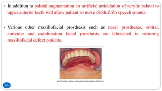 159
• In addition to palatal augmentation an artificial articulation of acrylic palatal to
upper anterior teeth will allow patient to make /S/Sh/Z/Zh speech sounds.
• Various other maxillofacial prosthesis such as nasal prostheses, orbital,
auricular and combination facial prosthesis are fabricated in restoring
maxillofacial defect patients.
 