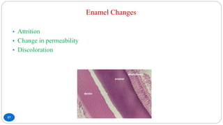 Enamel Changes
57
• Attrition
• Change in permeability
• Discoloration
 