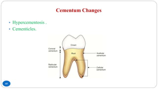 Cementum Changes
65
• Hypercementosis .
• Cementicles.
 