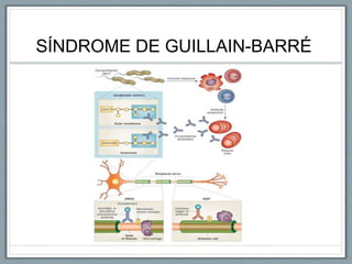 SÍNDROME DE GUILLAIN-BARRÉ
 