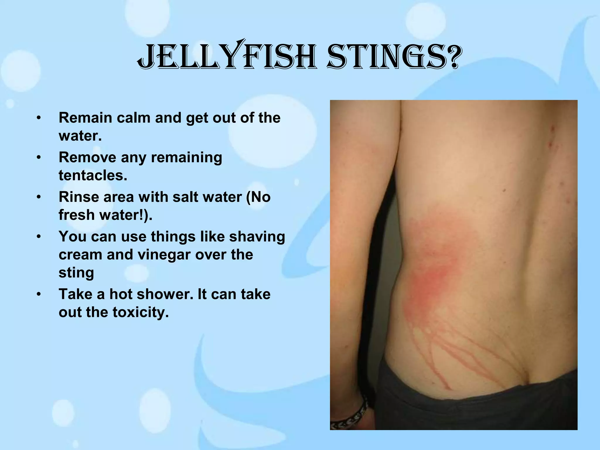 Jellyfish | PPT