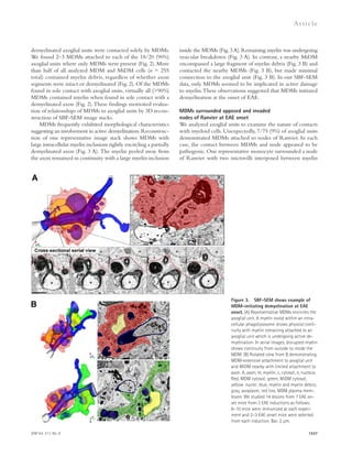 JEM Vol. 211, No. 8 
Ar t icle 
inside the MDMs (Fig. 3 A). Remaining myelin was undergoing 
vesicular breakdown (Fig. 3 A). In contrast, a nearby MiDM 
encompassed a large fragment of myelin debris (Fig. 3 B) and 
contacted the nearby MDMs (Fig. 3 B), but made minimal 
connection to the axoglial unit (Fig. 3 B). In our SBF-SEM 
data, only MDMs seemed to be implicated in active damage 
to myelin. These observations suggested that MDMs initiated 
demyelination at the onset of EAE. 
MDMs surrounded apposed and invaded 
nodes of Ranvier at EAE onset 
We analyzed axoglial units to examine the nature of contacts 
with myeloid cells. Unexpectedly, 7/75 (9%) of axoglial units 
demonstrated MDMs attached to nodes of Ranvier. In each 
case, the contact between MDMs and node appeared to be 
pathogenic. One representative monocyte surrounded a node 
of Ranvier with two microvilli interposed between myelin 
1537 
demyelinated axoglial units were contacted solely by MDMs. 
We found 2–3 MDMs attached to each of the 18/20 (90%) 
axoglial units where only MDMs were present (Fig. 2). More 
than half of all analyzed MDM and MiDM cells (n = 255 
total) contained myelin debris, regardless of whether axon 
segments were intact or demyelinated (Fig. 2). Of the MDMs 
found in sole contact with axoglial units, virtually all (90%) 
MDMs contained myelin when found in sole contact with a 
demyelinated axon (Fig. 2). These findings motivated evalua-tion 
of relationships of MDMs to axoglial units by 3D recon-struction 
of SBF-SEM image stacks. 
MDMs frequently exhibited morphological characteristics 
suggesting an involvement in active demyelination. Reconstruc-tion 
of one representative image stack shows MDMs with 
large intracellular myelin inclusions tightly encircling a partially 
demyelinated axon (Fig. 3 A). The myelin peeled away from 
the axon remained in continuity with a large myelin inclusion 
Figure 3. SBF-SEM shows example of 
MDM-initiating demyelination at EAE 
onset. (A) Representative MDMs encircles the 
axoglial unit. A myelin ovoid within an intra-cellular 
phagolysosome shows physical conti-nuity 
with myelin remaining attached to an 
axoglial unit which is undergoing active de-myelination. 
In serial images, disrupted myelin 
shows continuity from outside to inside the 
MDM. (B) Rotated view from B demonstrating 
MDM-extensive attachment to axoglial unit 
and MiDM nearby with limited attachment to 
axon. A, axon; m, myelin; c, cytosol; n, nucleus. 
Red, MDM cytosol; green, MiDM cytosol; 
yellow: nuclei; blue, myelin and myelin debris; 
gray, axoplasm; red line, MDM plasma mem-brane. 
We studied 14 lesions from 7 EAE on-set 
mice from 3 EAE inductions as follows: 
8–10 mice were immunized at each experi-ment 
and 2–3 EAE onset mice were selected 
from each induction. Bar, 2 μm. 
 