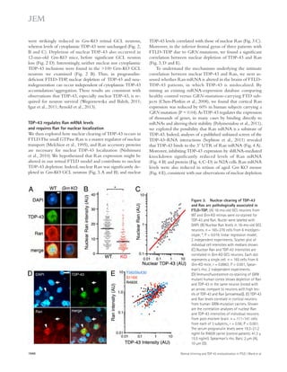 TDP-43 levels correlated with those of nuclear Ran (Fig. 3 C). 
Moreover, in the inferior frontal gyrus of three patients with 
FTLD-TDP due to GRN mutations, we found a significant 
correlation between nuclear depletion of TDP-43 and Ran 
(Fig. 3, D and E). 
To understand the mechanisms underlying the intimate 
correlation between nuclear TDP-43 and Ran, we next as-sessed 
whether Ran mRNA is altered in the brains of FTLD-TDP- 
43 patients, in which TDP-43 is mislocalized. By 
mining an existing mRNA-expression database comparing 
healthy control versus GRN-mutation-carrying FTD sub-jects 
(Chen-Plotkin et al., 2008), we found that cortical Ran 
expression was reduced by 60% in human subjects carrying a 
GRN mutation (P = 0.04). As TDP-43 regulates the expression 
of thousands of genes, in many cases by binding directly to 
mRNAs and altering their stability (Polymenidou et al., 2011), 
we explored the possibility that Ran mRNA is a substrate of 
TDP-43. Indeed, analyses of a published unbiased screen of the 
TDP-43–RNA interactions (Sephton et al., 2011) revealed 
that TDP-43 binds to the 3 UTR of Ran mRNA (Fig. 4 A). 
Moreover, inhibiting TDP-43 expression by shRNA-mediated 
knockdown significantly reduced levels of Ran mRNA 
(Fig. 4 B) and protein (Fig. 4, C–D) in N2A cells. Ran mRNA 
levels were also reduced in retinas of aged Grn KO mouse 
(Fig. 4 E), consistent with our observations of nuclear depletion 
were strikingly reduced in Grn-KO retinal GCL neurons, 
whereas levels of cytoplasmic TDP-43 were unchanged (Fig. 2, 
B and C). Depletion of nuclear TDP-43 also occurred in 
12-mo-old Grn-KO mice, before significant GCL neuron 
loss (Fig. 2 D). Interestingly, neither nuclear nor cytoplasmic 
TDP-43 inclusions were found in the 100 Grn-KO GCL 
neurons we examined (Fig. 2 B). Thus, in progranulin-deficient 
FTLD-TDP, nuclear depletion of TDP-43 and neu­rodegeneration 
can occur independent of cytoplasmic TDP-43 
accumulation/aggregation. These results are consistent with 
observations that TDP-43, especially nuclear TDP-43, is re-quired 
for neuron survival (Wegorzewska and Baloh, 2011; 
Igaz et al., 2011; Arnold et al., 2013). 
TDP-43 regulates Ran mRNA levels 
and requires Ran for nuclear localization 
We then explored how nuclear clearing of TDP-43 occurs in 
FTLD. The small GTPase Ran is a master regulator of nuclear 
transport (Melchior et al., 1995), and Ran accessory proteins 
are necessary for nuclear TDP-43 localization (Nishimura 
et al., 2010). We hypothesized that Ran expression might be 
altered in our retinal FTLD model and contribute to nuclear 
TDP-43 depletion. Indeed, nuclear Ran was significantly de-pleted 
in Grn-KO GCL neurons (Fig. 3, A and B), and nuclear 
Figure 3. Nuclear clearing of TDP-43 
and Ran are pathologically associated in 
FTLD-TDP. (A) 18-mo-old GCL neurons from 
WT and Grn-KO retinas were co-stained for 
TDP-43 and Ran. Nuclei were labeled with 
DAPI. (B) Nuclear Ran levels in 18-mo-old GCL 
neurons. n = 165–278 cells from 6 mice/gen-otype; 
*, P = 0.019, linear regression model; 
2 independent experiments. Scatter plot of 
individual cell intensities with medians shown. 
(C) Nuclear Ran and TDP-43 intensities are 
correlated in Grn-KO GCL neurons. Each dot 
represents a single cell. n = 165 cells from 6 
Grn-KO mice; r = 0.8963; P  0.001, Spear-man’s 
rho; 2 independent experiments. 
(D) Immunofluorescence co-staining of GRN 
mutant human cortex shows depletion of Ran 
and TDP-43 in the same neuron (noted with 
an arrow; compare to neurons with high lev-els 
of TDP-43 and Ran [arrowhead]). (E) TDP-43 
and Ran levels correlate in cortical neurons 
from human GRN-mutation carriers. Shown 
are the correlation analyses of nuclear Ran 
and TDP-43 intensities of individual neurons 
from post-mortem brain. n = 111–141 cells 
from each of 3 subjects;, r = 0.56; P  0.001. 
The serum progranulin levels were 19.3–21.2 
ng/ml for R493X carrier (control patients: 41.3 ± 
15.5 ng/ml). Spearman’s rho. Bars: 2 μm (A), 
10 μm (D). 
1940 Retinal thinning and TDP-43 mislocalization in FTLD | Ward et al. 
 