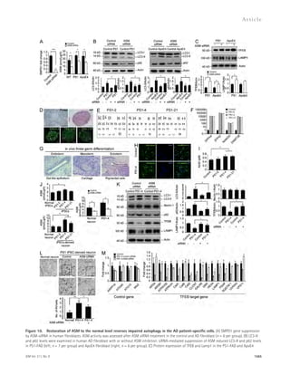 Figure 10. Restoration of ASM to the normal level reverses impaired autophagy in the AD patient-specific cells. (A) SMPD1 gene suppression 
by ASM-siRNA in human fibroblasts. ASM activity was assessed after ASM siRNA treatment in the control and AD fibroblast (n = 6 per group). (B) LC3-II 
and p62 levels were examined in human AD fibroblast with or without ASM inhibition. siRNA-mediated suppression of ASM reduced LC3-II and p62 levels 
in PS1-FAD (left; n = 7 per group) and ApoE4 fibroblast (right; n = 6 per group). (C) Protein expression of TFEB and Lamp1 in the PS1-FAD and ApoE4 
JEM Vol. 211, No. 8 
Ar t icle 
1565 
 