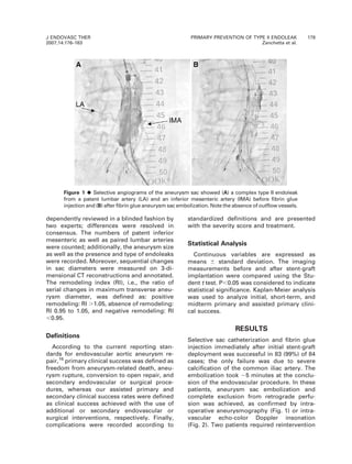 dependently reviewed in a blinded fashion by
two experts; differences were resolved in
consensus. The numbers of patent inferior
mesenteric as well as paired lumbar arteries
were counted; additionally, the aneurysm size
as well as the presence and type of endoleaks
were recorded. Moreover, sequential changes
in sac diameters were measured on 3-di-
mensional CT reconstructions and annotated.
The remodeling index (RI), i.e., the ratio of
serial changes in maximum transverse aneu-
rysm diameter, was defined as: positive
remodeling: RI .1.05, absence of remodeling:
RI 0.95 to 1.05, and negative remodeling: RI
,0.95.
Definitions
According to the current reporting stan-
dards for endovascular aortic aneurysm re-
pair,16
primary clinical success was defined as
freedom from aneurysm-related death, aneu-
rysm rupture, conversion to open repair, and
secondary endovascular or surgical proce-
dures, whereas our assisted primary and
secondary clinical success rates were defined
as clinical success achieved with the use of
additional or secondary endovascular or
surgical interventions, respectively. Finally,
complications were recorded according to
standardized definitions and are presented
with the severity score and treatment.
Statistical Analysis
Continuous variables are expressed as
means 6 standard deviation. The imaging
measurements before and after stent-graft
implantation were compared using the Stu-
dent t test. P,0.05 was considered to indicate
statistical significance. Kaplan-Meier analysis
was used to analyze initial, short-term, and
midterm primary and assisted primary clini-
cal success.
RESULTS
Selective sac catheterization and fibrin glue
injection immediately after initial stent-graft
deployment was successful in 83 (99%) of 84
cases; the only failure was due to severe
calcification of the common iliac artery. The
embolization took ,5 minutes at the conclu-
sion of the endovascular procedure. In these
patients, aneurysm sac embolization and
complete exclusion from retrograde perfu-
sion was achieved, as confirmed by intra-
operative aneurysmography (Fig. 1) or intra-
vascular echo-color Doppler insonation
(Fig. 2). Two patients required reintervention
Figure 1 ¤Selective angiograms of the aneurysm sac showed (A) a complex type II endoleak
from a patent lumbar artery (LA) and an inferior mesenteric artery (IMA) before fibrin glue
injection and (B) after fibrin glue aneurysm sac embolization. Note the absence of outflow vessels.
J ENDOVASC THER
2007;14:176–183
PRIMARY PREVENTION OF TYPE II ENDOLEAK 179
Zanchetta et al.
 