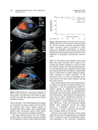within 30 days: 1 for failed deployment (grade
2; conversion to open surgery) and the other
for external iliac artery rupture (grade 2;
surgical iliac artery repair). One symptomatic
patient with contained rupture died within
30 days (1.2% procedure-related mortality).
The mean follow-up was 14.468.7 months
(range 2–30); a 2-year follow-up was available
for 31 patients. A total of 424 imaging studies
(both CT and echo-color Doppler scans) and
348 visits were recorded, for a mean of 5.1
studies per patient (range 2–7) and 4.2 visits
per patient (range 1–5). The estimated prima-
ry and assisted primary clinical success rates
at 2 years were 91.3% and 98.8%, respectively
(Fig. 3). There were no early allergic-anaphy-
lactic reactions or tissue reactions in the
aneurysm sac or in the surrounding struc-
tures due to the fibrin glue injection during
the study period.
Four complications requiring reintervention
in follow-up included 2 implant-related com-
plications: 1 due to postoperative graft mi-
gration (grade 2; additional endovascular
aortic cuff) and the other to postoperative
endograft limb thrombosis (grade 3; femoro-
femoral bypass). Two systemic complications
were due to renal insufficiency because of
partial stent-graft coverage of the renal ar-
teries (grade 1; renal angioplasty and stent-
ing). Moreover, 4 late non-aneurysm-related
deaths were observed during the study
period: 2 metastatic cancers at 6 and
12 months, 1 colonic necrosis at 6 months,
and 1 sudden death at 15 months.
However, the major findings of this study
were the low rate of delayed type II endoleak
(2.4%, 2 patients) and the statistically signif-
icant decrease in the maximum transverse
Figure 2 ¤Intravascular ultrasound examples of
(A) an empty aneurysm sac at baseline, (B) a pre-
embolization sac with flow from inflow vessels,
and (C) a sac after fibrin glue injection and type II
endoleak occlusion.
Figure 3 ¤Kaplan-Meier estimates of primary and
assisted primary clinical success. Adverse events
for primary success included aneurysm-related
death, aneurysm rupture, conversion to open
repair, and secondary endovascular or surgical
procedures. Assisted primary clinical success was
defined as clinical success achieved with the use of
additional or secondary endovascular interven-
tions.
180 PRIMARY PREVENTION OF TYPE II ENDOLEAK
Zanchetta et al.
J ENDOVASC THER
2007;14:176–183
 