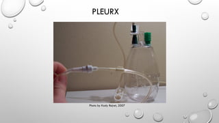 jenefa pleural effusion.pptx usefulness namaste | PPTX