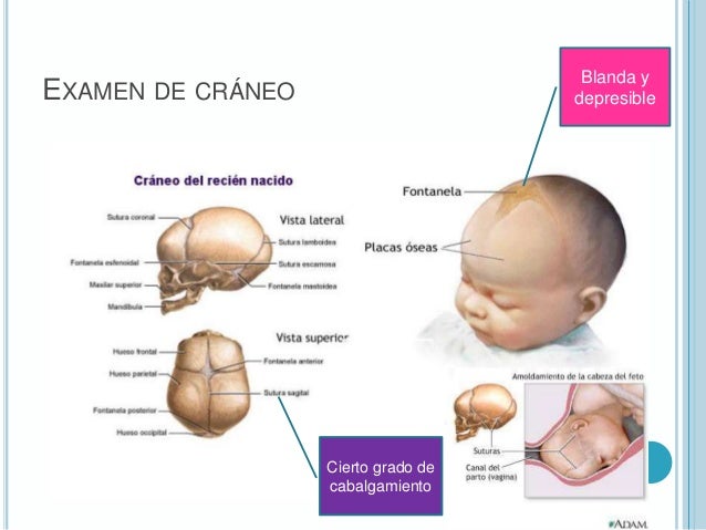 En Recien Nacidos Espacio Sin Osificar Del Craneo es.slideshare.net