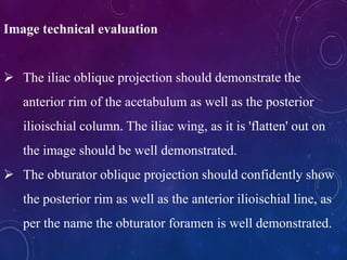 Image technical evaluation
 The iliac oblique projection should demonstrate the
anterior rim of the acetabulum as well as the posterior
ilioischial column. The iliac wing, as it is 'flatten' out on
the image should be well demonstrated.
 The obturator oblique projection should confidently show
the posterior rim as well as the anterior ilioischial line, as
per the name the obturator foramen is well demonstrated.
 