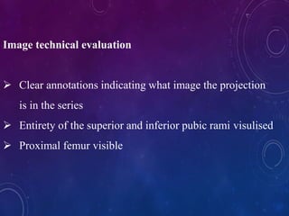 Image technical evaluation
 Clear annotations indicating what image the projection
is in the series
 Entirety of the superior and inferior pubic rami visulised
 Proximal femur visible
 