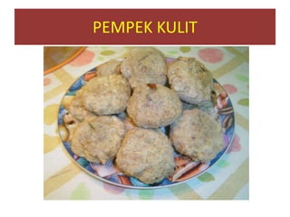 PEMPEK KULIT
 