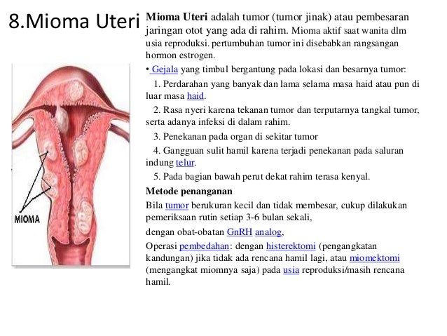 Penyakit Pada Sistem Reproduksi Yang Disebabkan Oleh Virus Adalah