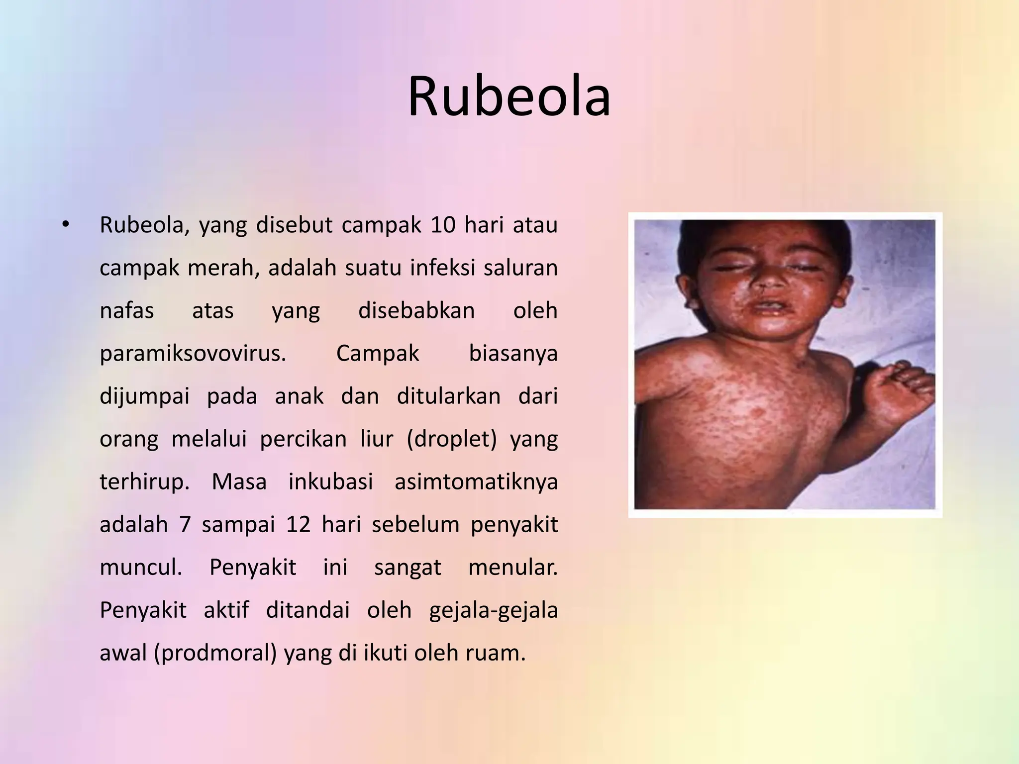 jenis jenis penyakit infeksi di sekitar kita | PPTX