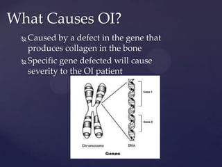 What Causes OI?Caused by a defect in the gene that produces collagen in the boneSpecific gene defected will cause severity to the OI patient