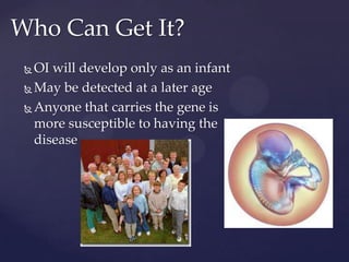 Who Can Get It?OI will develop only as an infantMay be detected at a later ageAnyone that carries the gene is more susceptible to having the disease 