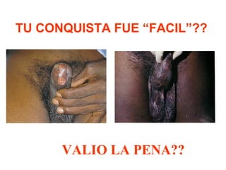 TU CONQUISTA FUE “FACIL”??
VALIO LA PENA??
 