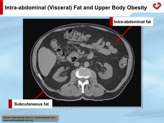 Fatty acid metabolism in humans