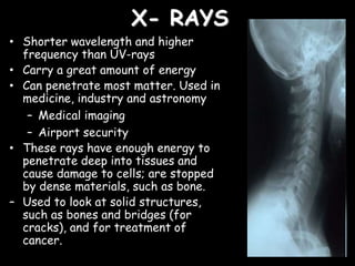 X- RAYS
• Shorter wavelength and higher
frequency than UV-rays
• Carry a great amount of energy
• Can penetrate most matter. Used in
medicine, industry and astronomy
– Medical imaging
– Airport security
• These rays have enough energy to
penetrate deep into tissues and
cause damage to cells; are stopped
by dense materials, such as bone.
– Used to look at solid structures,
such as bones and bridges (for
cracks), and for treatment of
cancer.
 