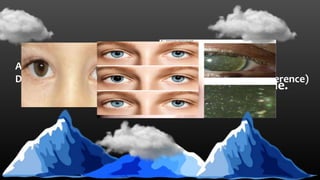 Abnormal:
Congenital Miosis:
tapetoretinal degenrations can be isolated finding.
Persistent Mydriasis:
Develops during the second or third decade.
Anisocoria:
Difference in the size of two pupils (cor: pupil, aniso: difference)
 