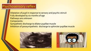 Psychosensory reflex
Dilatation of pupil in response to sensory and psychic stimuli
Fully developed by six months of age
Pathways are unknown
Components:
Sympathetic discharge to dilator pupillae muscle
Inhibition of parasympathetic discharge to sphincter pupillae muscle
 
