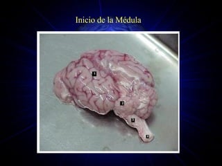 Inicio de la Médula 