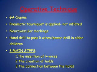 Distractor DevicesThe double holeThe fish mouth The split block The biaxial hinge Connecting  rods- standard connecting rods in the small and medium set is 3 mm rod.