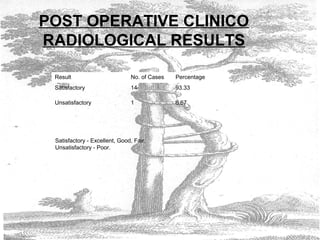 POST OPERATIVE CLINICO
RADIOLOGICAL RESULTS
Result No. of Cases Percentage
Satisfactory 14 93.33
Unsatisfactory 1 6.67
Satisfactory - Excellent, Good, Fair.
Unsatisfactory - Poor.
 