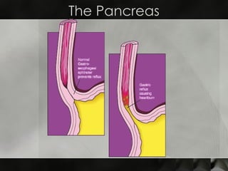 The Pancreas 
