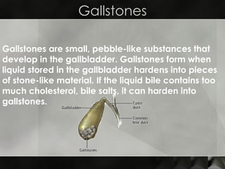 Gallstones Gallstones are small, pebble-like substances that develop in the gallbladder. Gallstones form when liquid stored in the gallbladder hardens into pieces of stone-like material. If the liquid bile contains too much cholesterol, bile salts, it can harden into gallstones. 