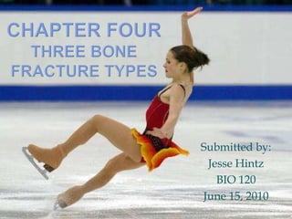 Chapter FourThree Bone Fracture Types Submitted by: Jesse Hintz BIO 120 June 15, 2010 