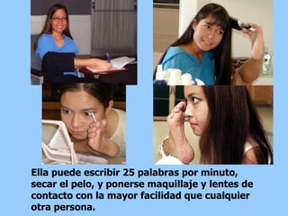 Ella puede escribir 25 palabras por minuto, secar el pelo, y ponerse maquillaje y lentes de contacto con la mayor facilidad que cualquier otra persona.  