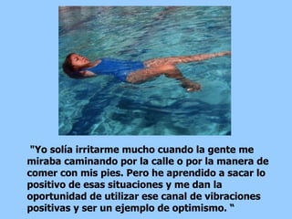 "Yo solía irritarme mucho cuando la gente me miraba caminando por la calle o por la manera de comer con mis pies. Pero he aprendido a sacar lo positivo de esas situaciones y me dan la oportunidad de utilizar ese canal de vibraciones positivas y ser un ejemplo de optimismo. “ 