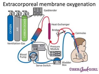 Extracorporeal membrane oxygenation
 