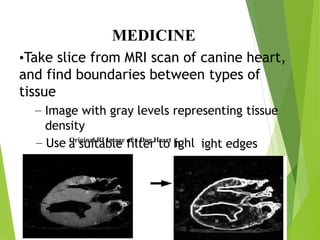 MEDICINE
•Take slice from MRI scan of canine heart,
and find boundaries between types of
tissue
– Image with gray levels representing tissue
density
a suitable filter to h ight edges
– Use Original RI Image of a Dog Heart
ighl
 