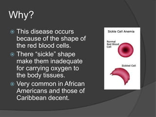 Why?This disease occurs because of the shape of the red blood cells. There “sickle” shape make them inadequate for carrying oxygen to the body tissues.Very common in African Americans and those of Caribbean decent. 
