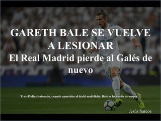 GARETH BALE SE VUELVE
A LESIONAR
El Real Madrid pierde al Galés de
nuevo
Jesús Sarcos
Tras 45 días lesionado, cuando apuntaba al derbi madrileño, Bale se ha vuelto a romper.
 
